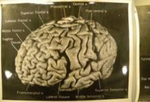 Сколько весит мозг? Вес мозга и интеллект. Национальные особенности Мозг тургенева весил