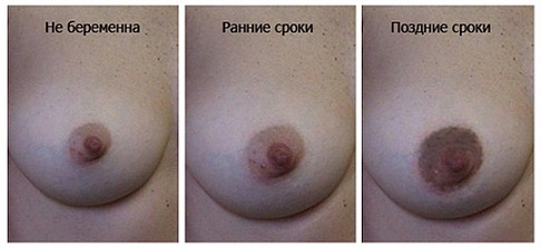 Стройная девушка со светлыми сосками... (20 фото)